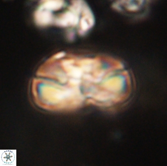 Heliolithus iptamenosdiskos 63202