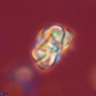 Heliolithus iptamenosdiskos 65679