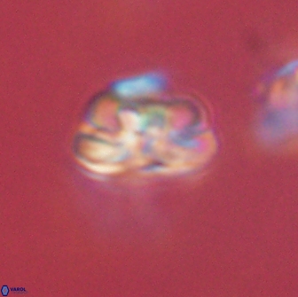 Heliolithus iptamenosdiskos 65687