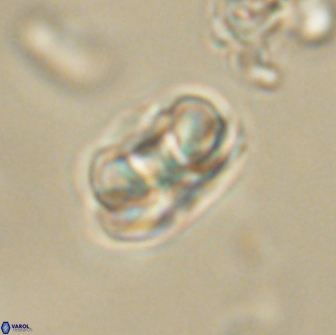 Heliolithus iptamenosdiskos 65695