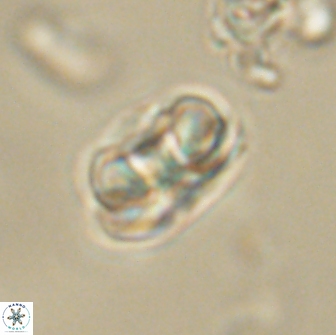 Heliolithus iptamenosdiskos 65695