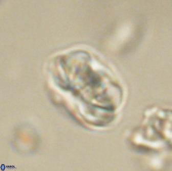 Heliolithus iptamenosdiskos 65700