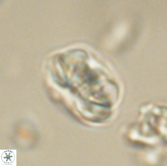 Heliolithus iptamenosdiskos 65700