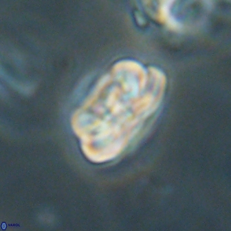 Heliolithus iptamenosdiskos 65705