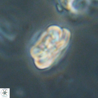 Heliolithus iptamenosdiskos 65705