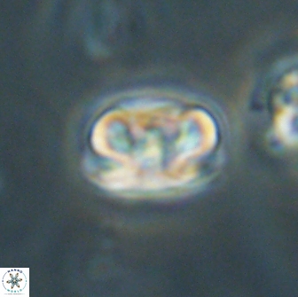 Heliolithus iptamenosdiskos 65706