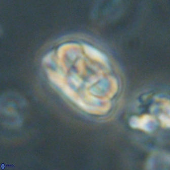 Heliolithus iptamenosdiskos 65707