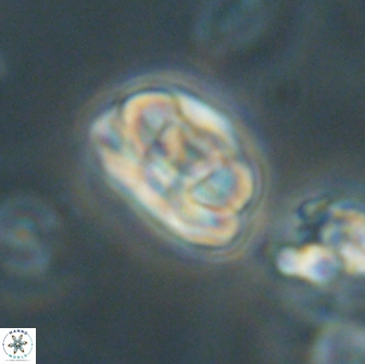 Heliolithus iptamenosdiskos 65707