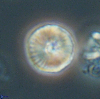 Heliolithus iptamenosdiskos 65708