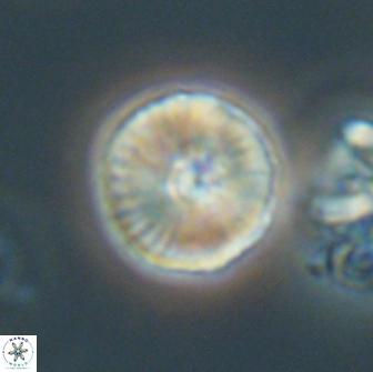 Heliolithus iptamenosdiskos 65708