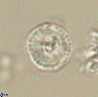 Heliolithus iptamenosdiskos 65710