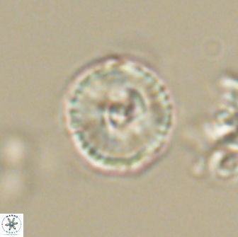 Heliolithus iptamenosdiskos 65710
