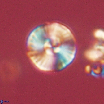 Heliolithus iptamenosdiskos 65712