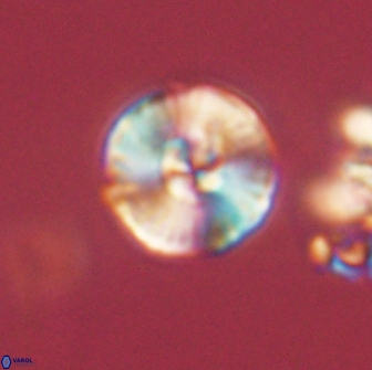 Heliolithus iptamenosdiskos 65713