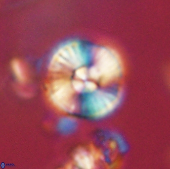 Heliolithus iptamenosdiskos 65717