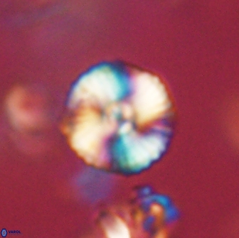 Heliolithus iptamenosdiskos 65718