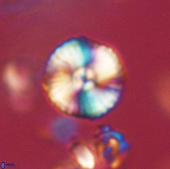 Heliolithus iptamenosdiskos 65721