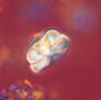 Heliolithus iptamenosdiskos 65722