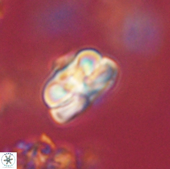 Heliolithus iptamenosdiskos 65722