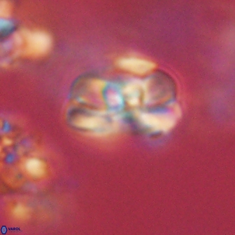 Heliolithus iptamenosdiskos 65727