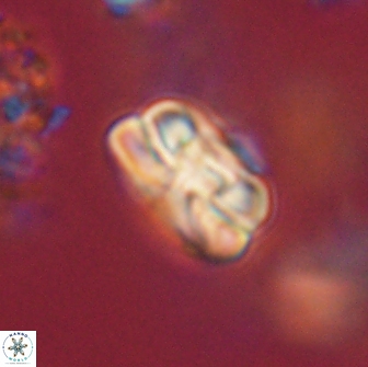 Heliolithus iptamenosdiskos 65730