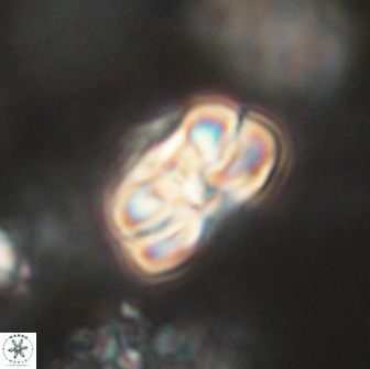 Heliolithus iptamenosdiskos 65738