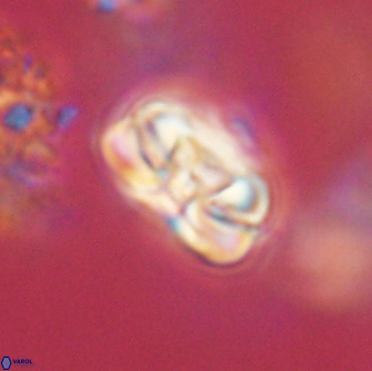 Heliolithus iptamenosdiskos 65740