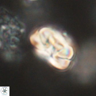 Heliolithus iptamenosdiskos 65742