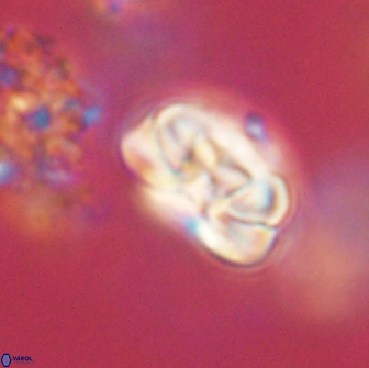 Heliolithus iptamenosdiskos 65743