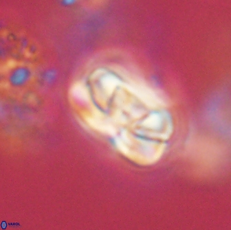 Heliolithus iptamenosdiskos 65744