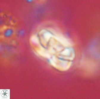 Heliolithus iptamenosdiskos 65744