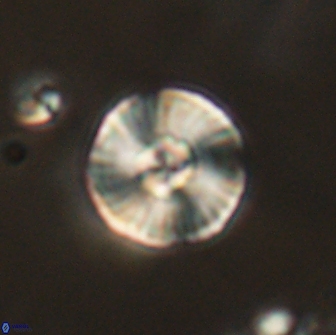 Heliolithus iptamenosdiskos 65746