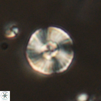 Heliolithus iptamenosdiskos 65746