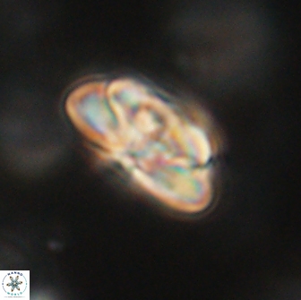 Heliolithus iptamenosdiskos 65751