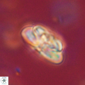 Heliolithus iptamenosdiskos 65752