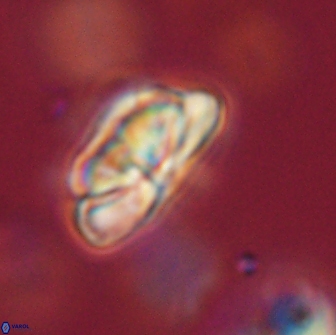 Heliolithus iptamenosdiskos 65755