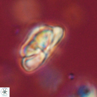 Heliolithus iptamenosdiskos 65755