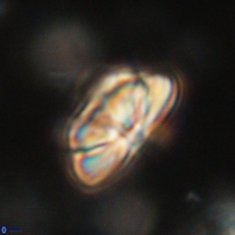 Heliolithus iptamenosdiskos 65757