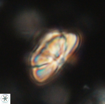 Heliolithus iptamenosdiskos 65757