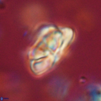 Heliolithus iptamenosdiskos 65758