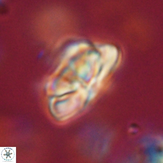 Heliolithus iptamenosdiskos 65758