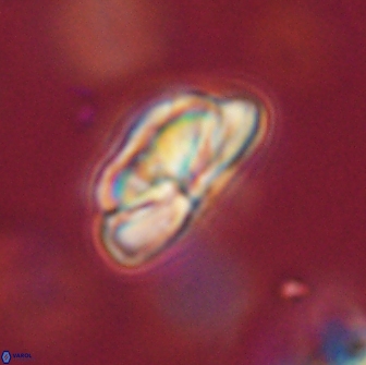 Heliolithus iptamenosdiskos 65759