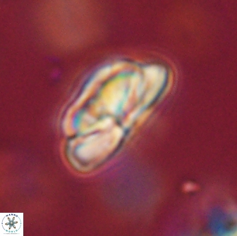 Heliolithus iptamenosdiskos 65759