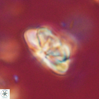 Heliolithus iptamenosdiskos 65763