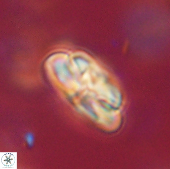 Heliolithus iptamenosdiskos 65764