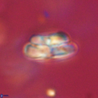 Heliolithus iptamenosdiskos 65767