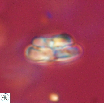 Heliolithus iptamenosdiskos 65767