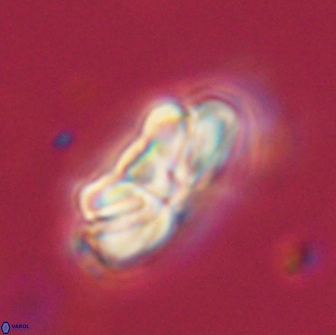 Heliolithus iptamenosdiskos 65771