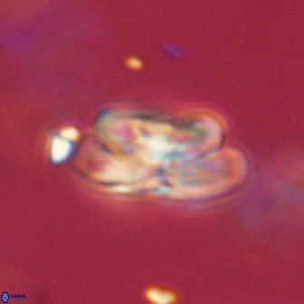 Heliolithus iptamenosdiskos 65779