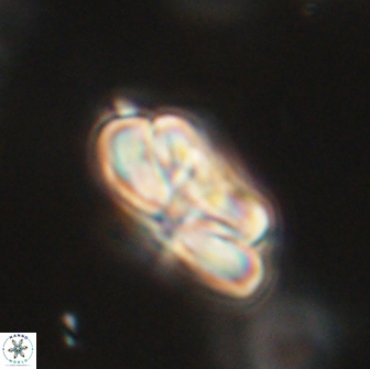 Heliolithus iptamenosdiskos 65781